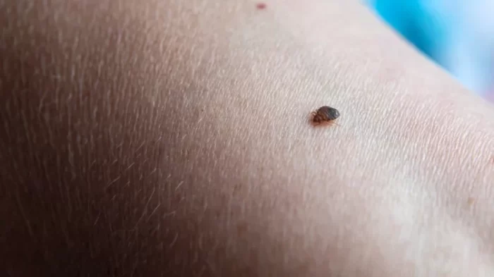 Baby Bed Bugs - Bites, Pictures, Control & Look ALikes