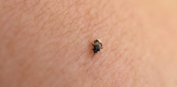 Tiny Little Black Bugs That Bite and Itch